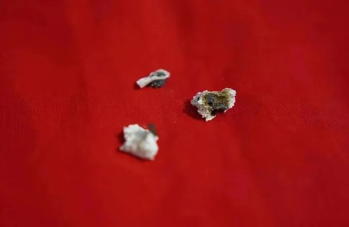 他去世了，骨灰中發(fā)現3枚彈片……